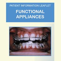 Functional braces such as the Twin Block are a very popular way of reducing the projection of the top teeth. Read more about what to expect and how to look after these effective appliances