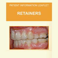 Keeping the teeth straight once the braces are removed is extremely important and retainers are needed in almost all cases. Find out more in this leaflet